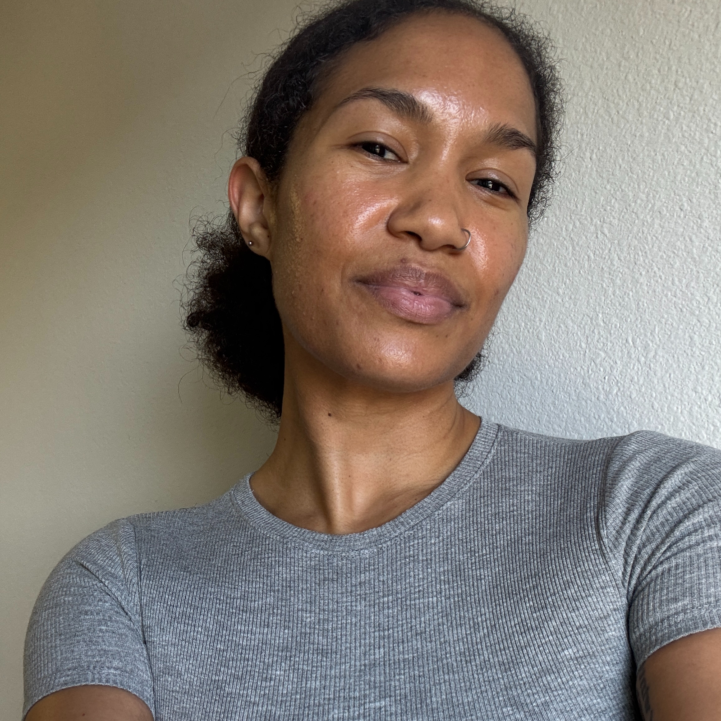 A beauty editor's dark spots before using The Outset's Total Clarity Serum